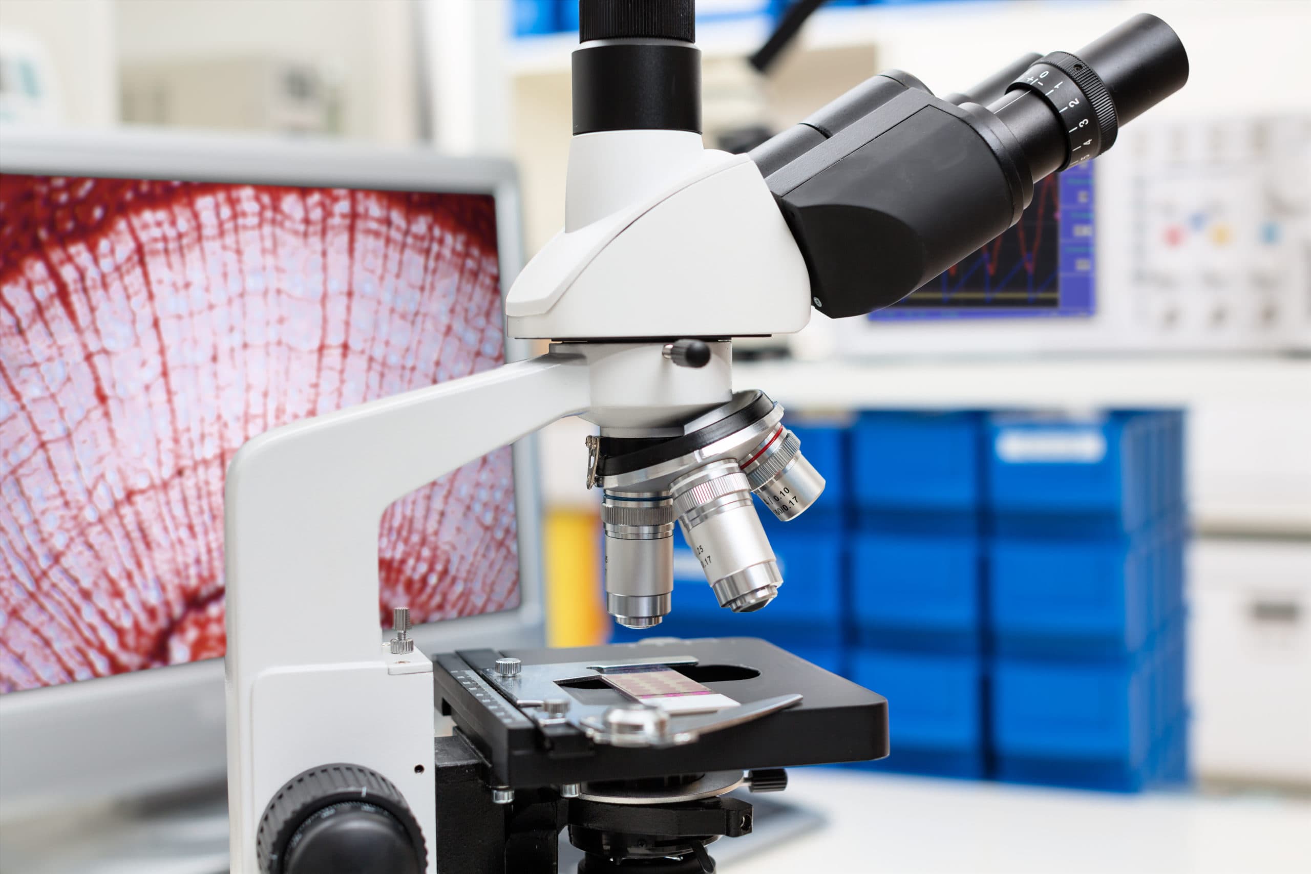 Digitalization of Pathology A New Approach Kvalito